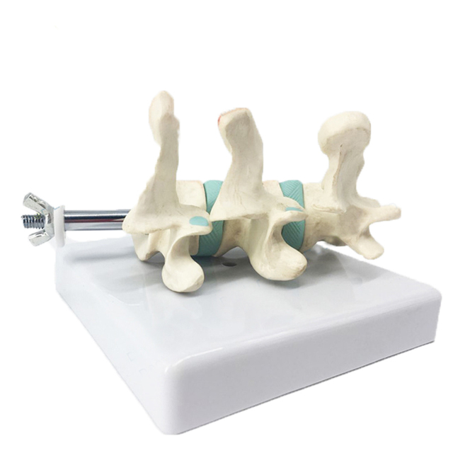 Model anatomiczny kręgów lędźwiowych do nauki medycyny - ból ortopedyczny - Wianko - 6