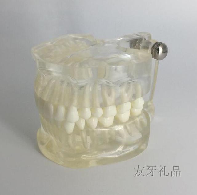 Nauka medyczna - Model zęba demonstracyjny z odpinanymi częściami - Wianko - 3