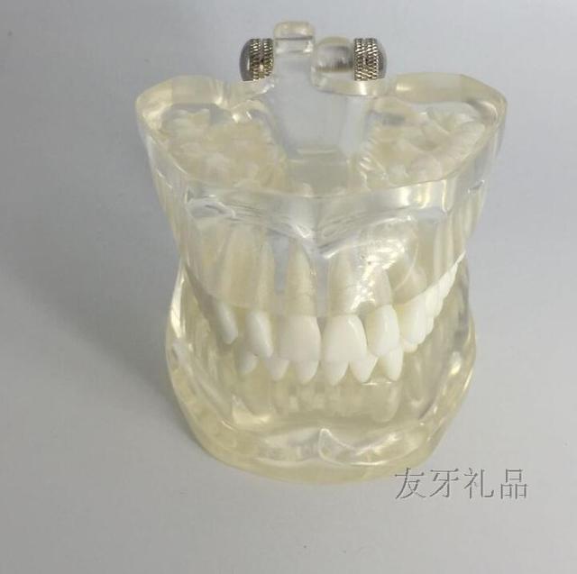Nauka medyczna - Model zęba demonstracyjny z odpinanymi częściami - Wianko - 2