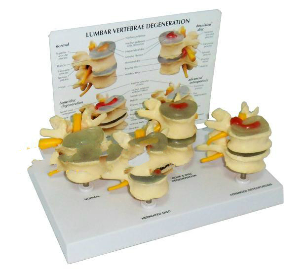 Model zmiennej lędźwiowej - Cztery typy kręgosłupa, przykłady choroby dysku - Sprzęt edukacyjny - Wianko - 72